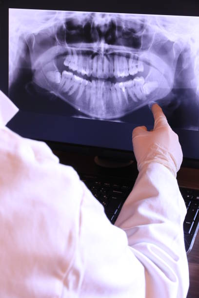 Best Broken or Cracked Tooth Emergency Dentist in Parma Heights, OH