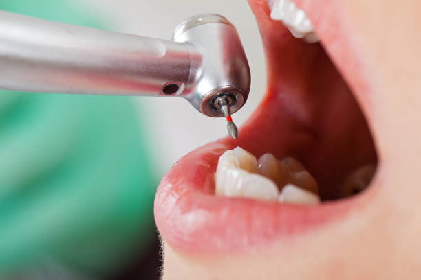 Best Emergency Dental Services for Seniors in Parma Heights, OH